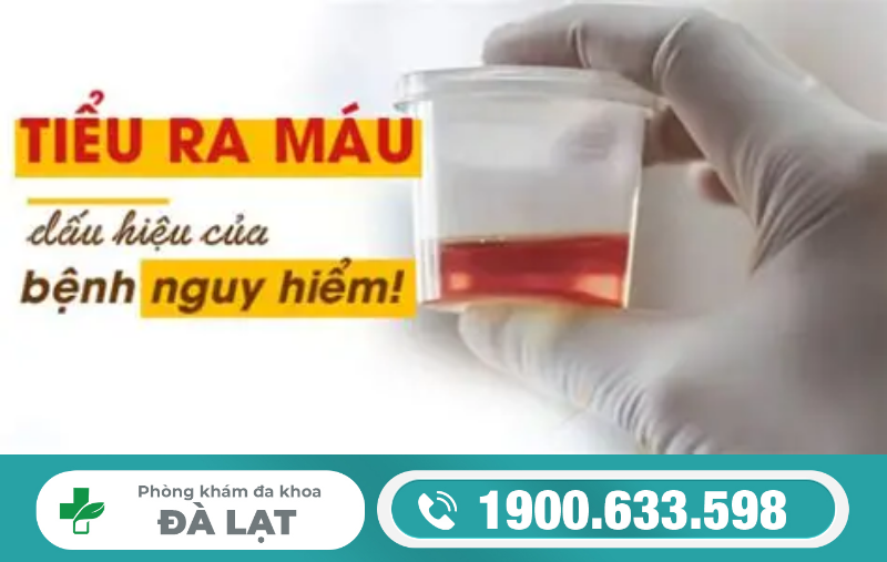 Hình ảnh minh họa